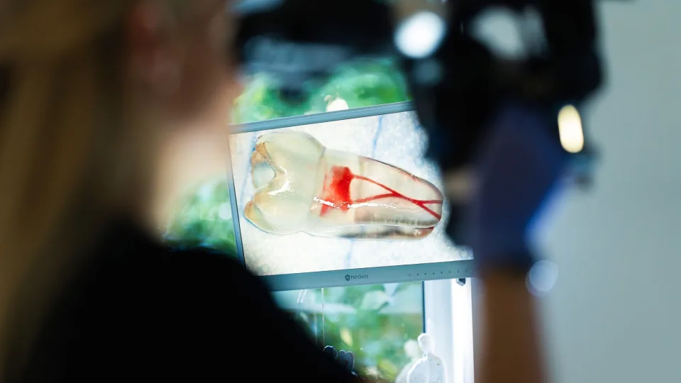 Endodontoloogi saladus: mida hambaarstid ei räägi