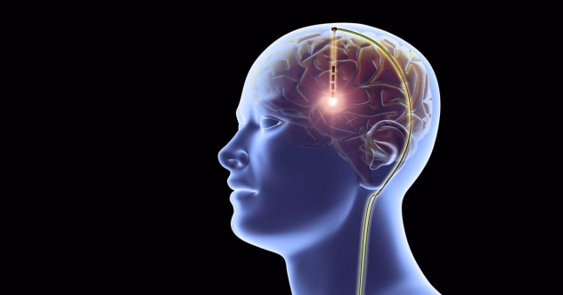 Detailide vältimine võib viia hilisemate vigadeni